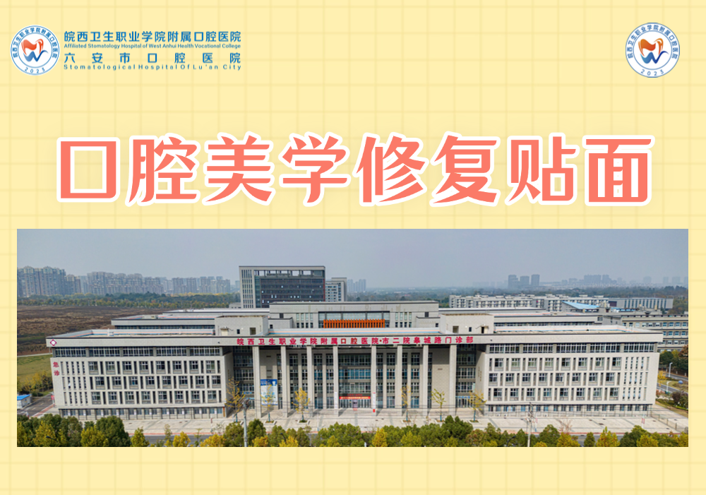 口腔美学修复贴面